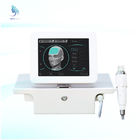 Secret RF Microneedles Fractional RF Scar Removal Stretchmarks Removal RF Machine